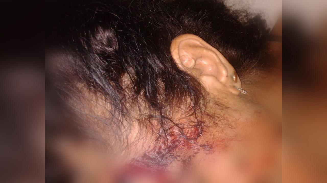 De acordo com a Polícia Civil, a idosa já foi lesionada várias vezes (Foto: Divulgação)