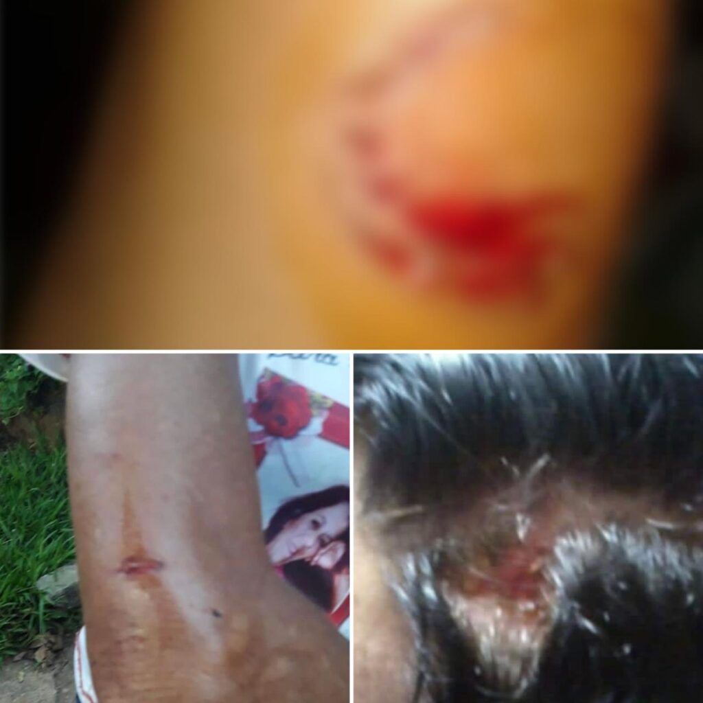 Idosa ficou lesionada em várias partes do corpo (Foto: Divulgação-Polícia Civil)