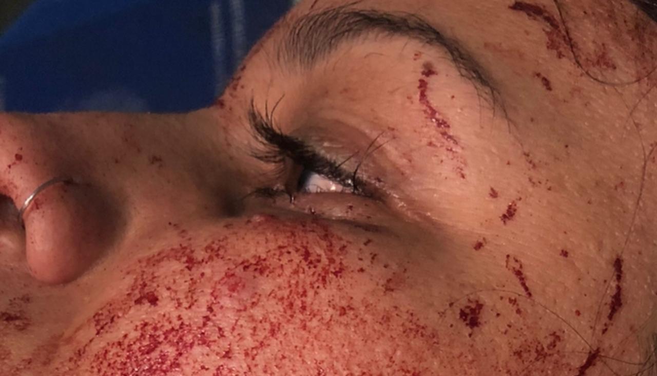 Vítima, de 28 anos, ficou com o rosto ensanguentado após as agressões (Foto: Cedida à Rádio São Francisco)