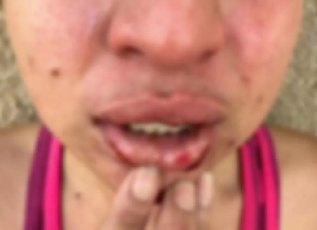 Lábios da mulher ficaram sangrando após as agressões (Foto: Reprodução)