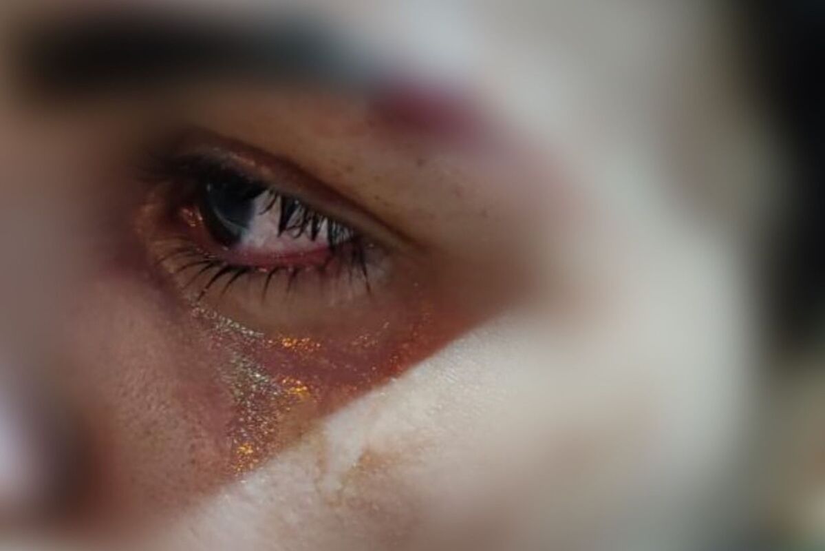 Vítima sofreu corte na sobrancelha durante o assalto (Foto: Reprodução)