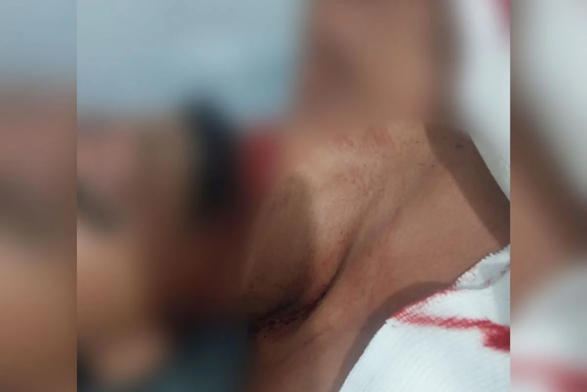 Homem sofreu corte profundo no pescoço (Foto: Cedida à Rádio São Francisco FM)