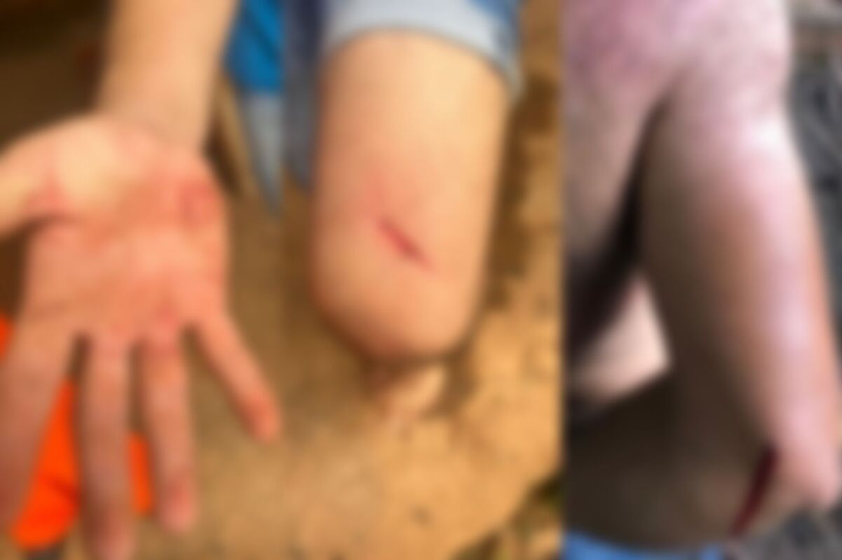 Vítimas relatam que ficaram feridas após golpes de foice (Foto: Reprodução/PM)
