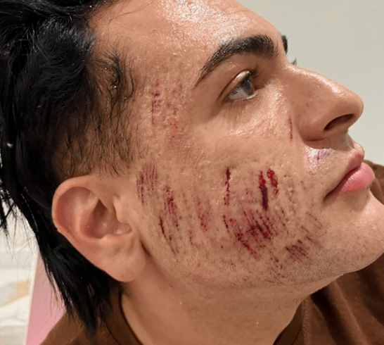 Fotos tiradas pelo namorado de Henrique mostram marcas e sangramentos em seu rosto. (Foto: Reprodução)